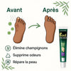Pommade de confort pour les pieds – Bien-être quotidien pour Hommes et Femmes