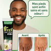 Pommade de confort pour les pieds – Bien-être quotidien pour Hommes et Femmes