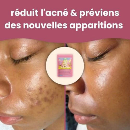 Cottons Nettoyant Anti Imperfection