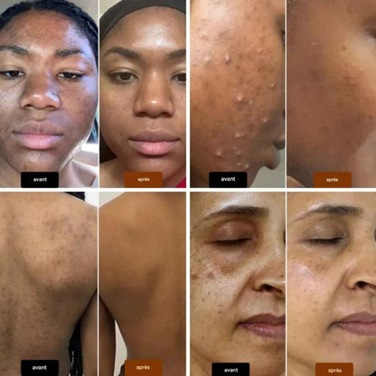 Savon Doux Éclat Africain