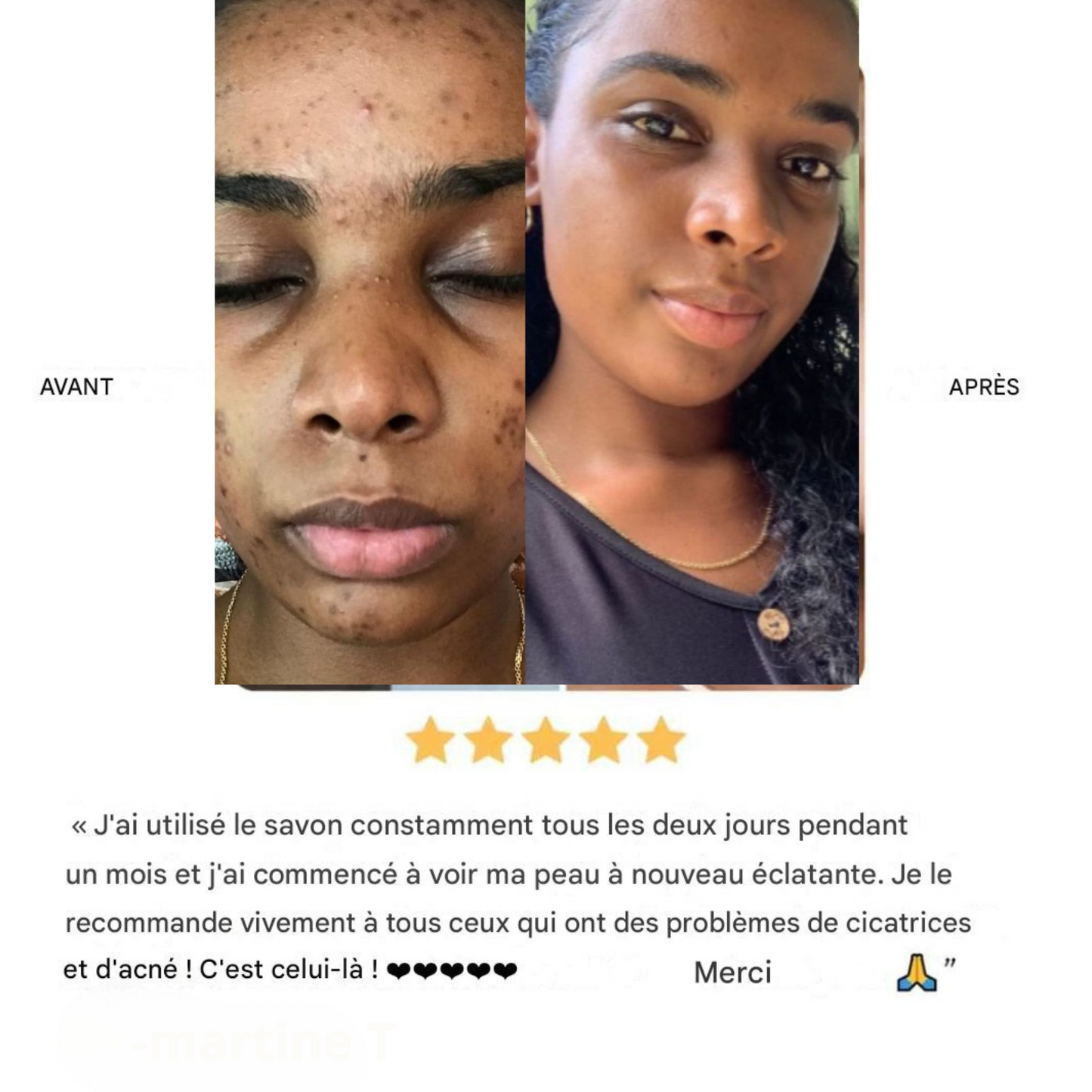 Savon Doux Éclat Africain